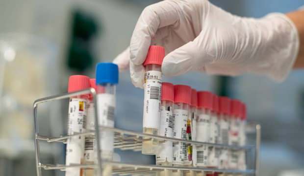 Koronavirusa qarşı faydalı dərmanın adı açıqlandı  