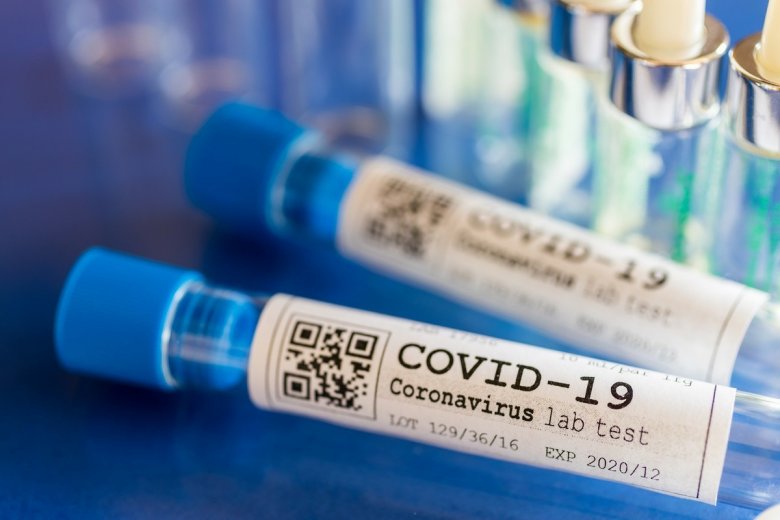 Fransada koronavirus dərmanı uğurla sınaqdan keçirilib