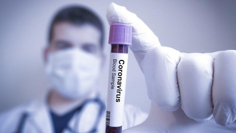 Azərbaycanda daha 63 nəfər koronavirusa yoluxub