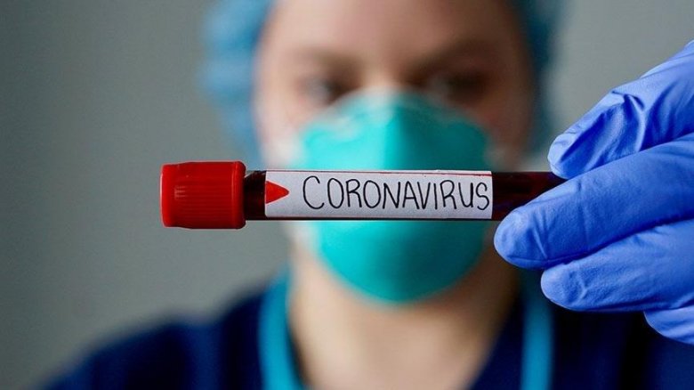 Ölkəmizdə daha 3656 nəfər koronavirusla bağlı test olunub