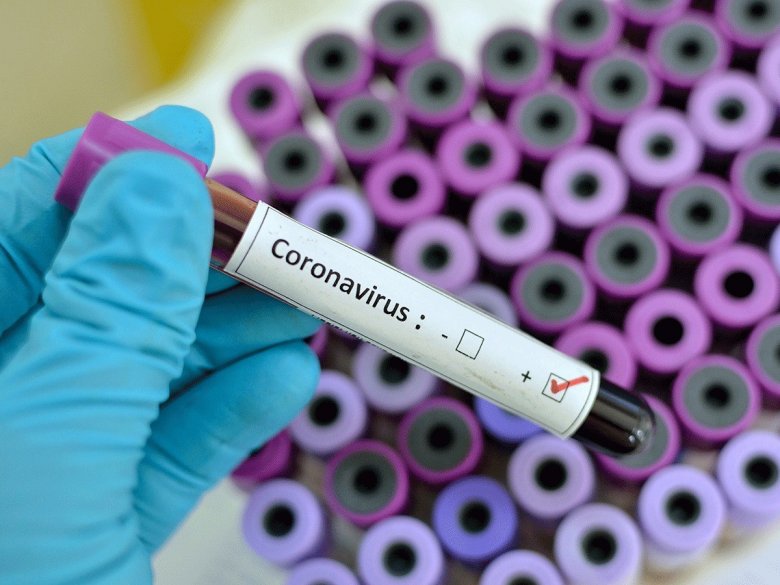 Qocalar evində 35 nəfərdə koronavirus aşkarlanıb