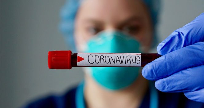 Ölkəmizdə koronavirusa yoluxanların sayı artır
