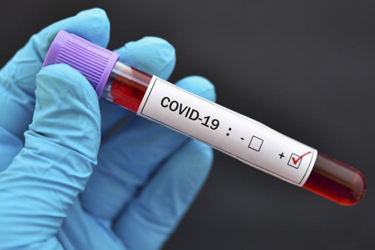 Hindistanda koronavirusa yoluxanların sayı milyonu ötüb