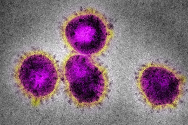 İranda daha 2625 nəfər koronavirusa yoluxub