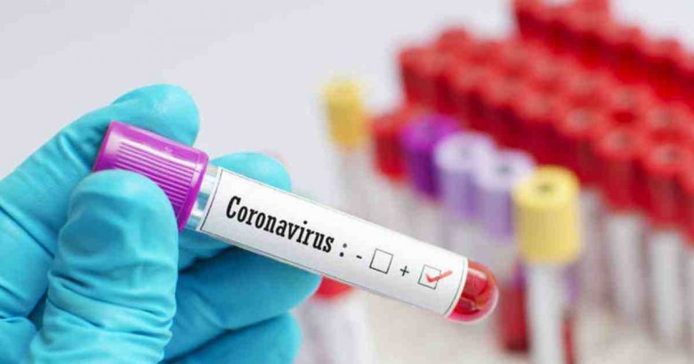 Azərbaycanda daha 339 nəfər koronavirusa yoluxub, 3 nəfər vəfat edib