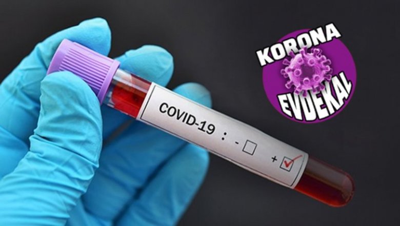 Azərbaycanda daha 129 nəfər koronavirusa yoluxub, ölənlər var