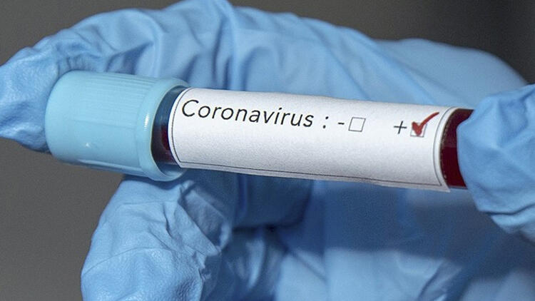 Azərbaycanda koronavirusa 98 yeni yoluxma qeydə alınıb