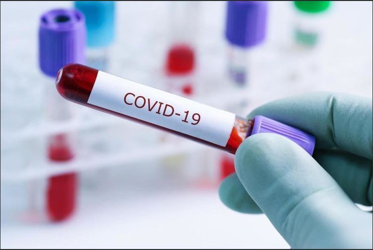 Azərbaycanda daha 714 nəfər koronavirusa yoluxub, 7 nəfər vəfat edib