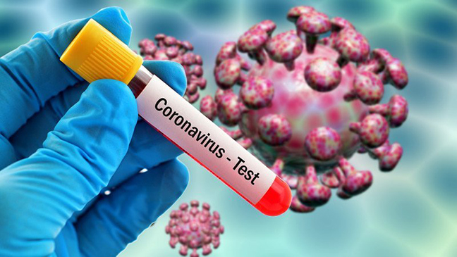 Ölkə üzrə koronavirusa yoluxma statistikası açıqlanıb