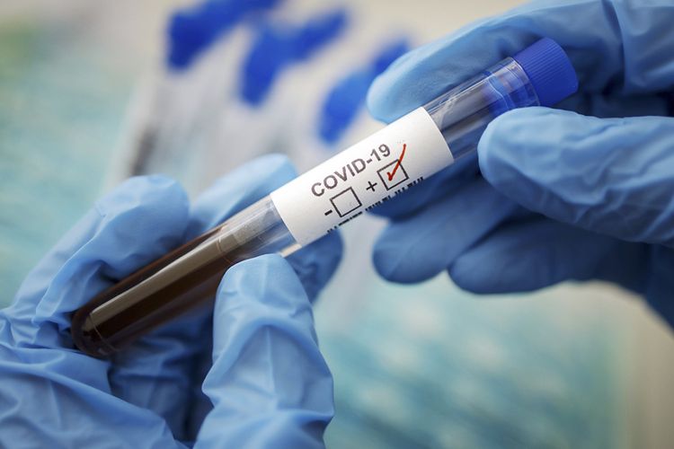 Daha iki koronavirus xəstəsi saxlanılıb