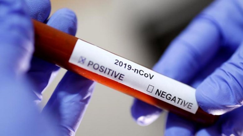Gürcüstanda koronavirusdan daha 74 nəfər ölüb