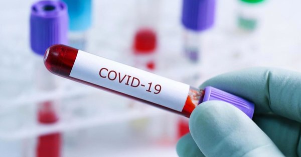 Ölkəmizdə koronavirusdan daha 32 nəfər vəfat edib